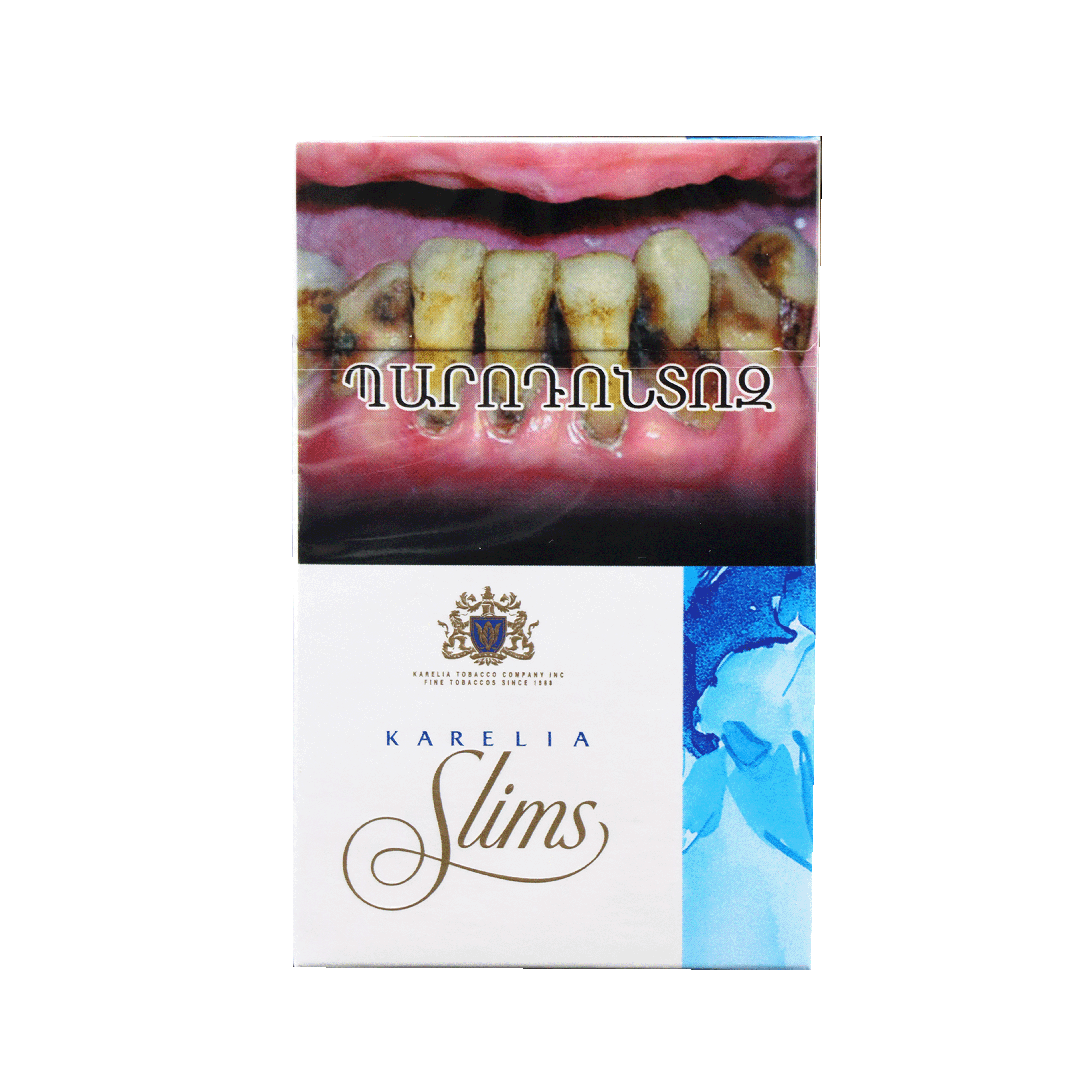 tobacco dust eye seen in The Shaffer sign, also known as “tobacco dust,” is a clinical finding seen  in retinal detachment. It refers to the presence of small, pigmented cells  or pigment clumps in the anterior vitreous,